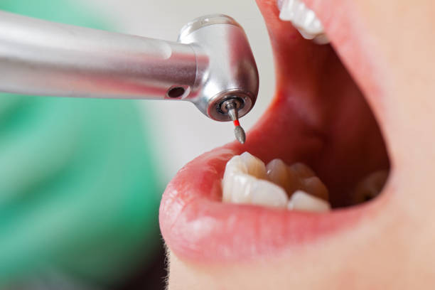 Best Emergency Broken Tooth Repair in Ontonagon, MI